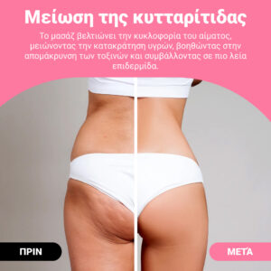 Alternative view of Guasha™ – Φυσικός Κύλινδρος Μασάζ Gua Sha